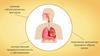 Заболевания органов дыхания, их профилактика. Реанимация