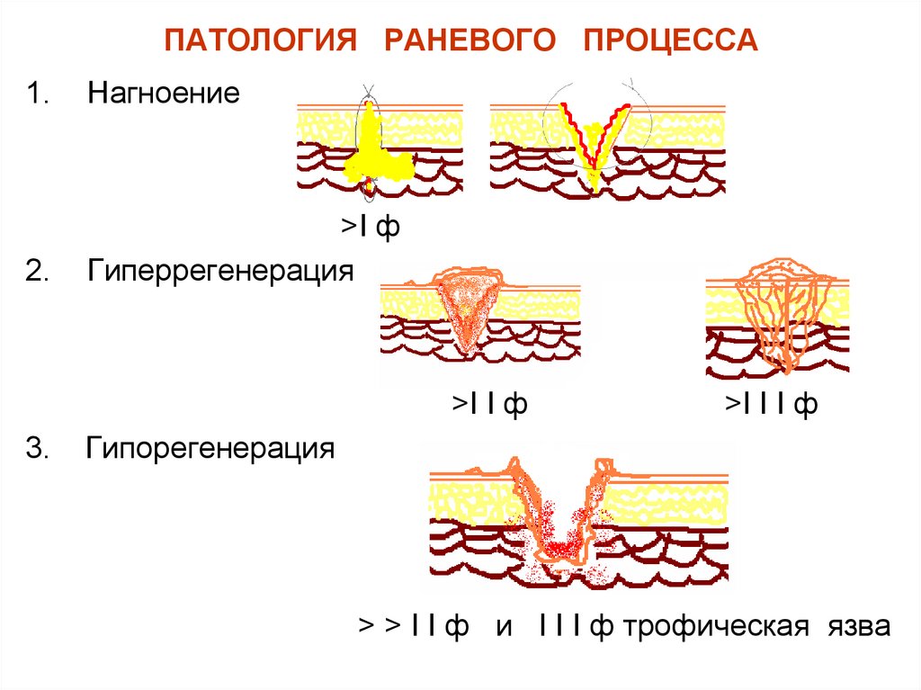 Кс рана. Процесс заживления РАН схема. Заживление РАН – раневой процесс. Фазы заживления РАН схема. Фазы раневого процесса заживления РАН.