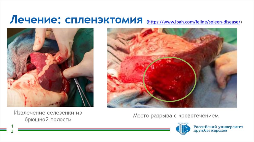 Лечение: спленэктомия (https://www.lbah.com/feline/spleen-disease/)