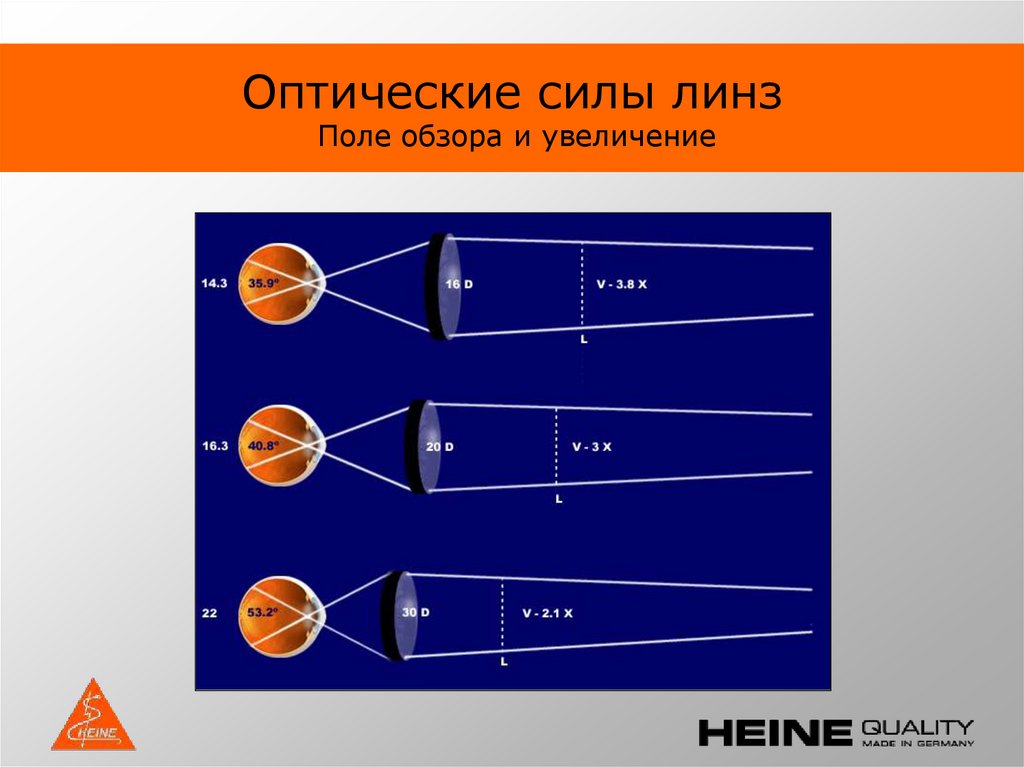 Поле обзора. Прямая офтальмоскопия схема. Техника непрямой офтальмоскопии. Преимущества прямой офтальмоскопии.