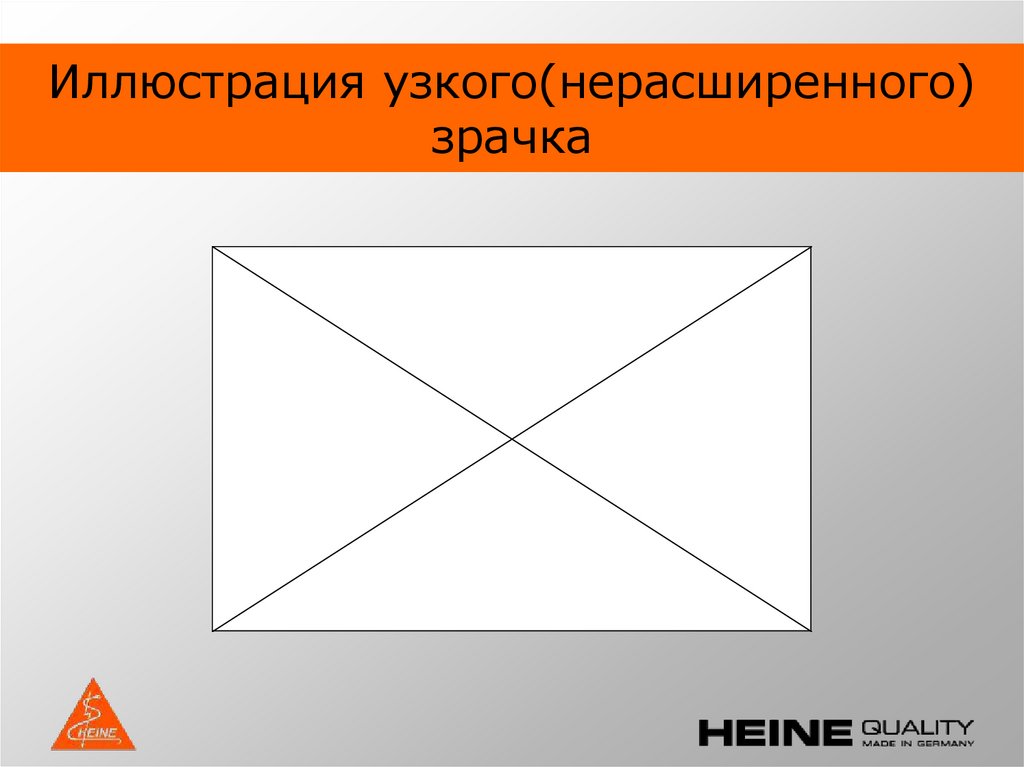 Иллюстрация узкого(нерасширенного) зрачка