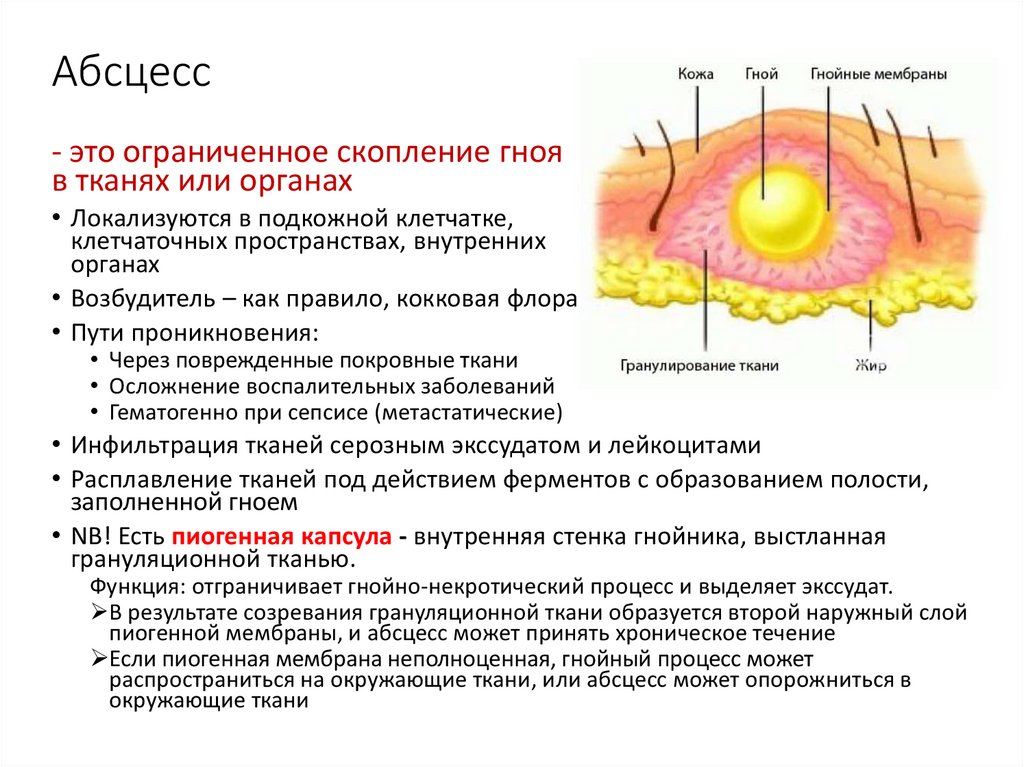 Абсцесс клинические проявление