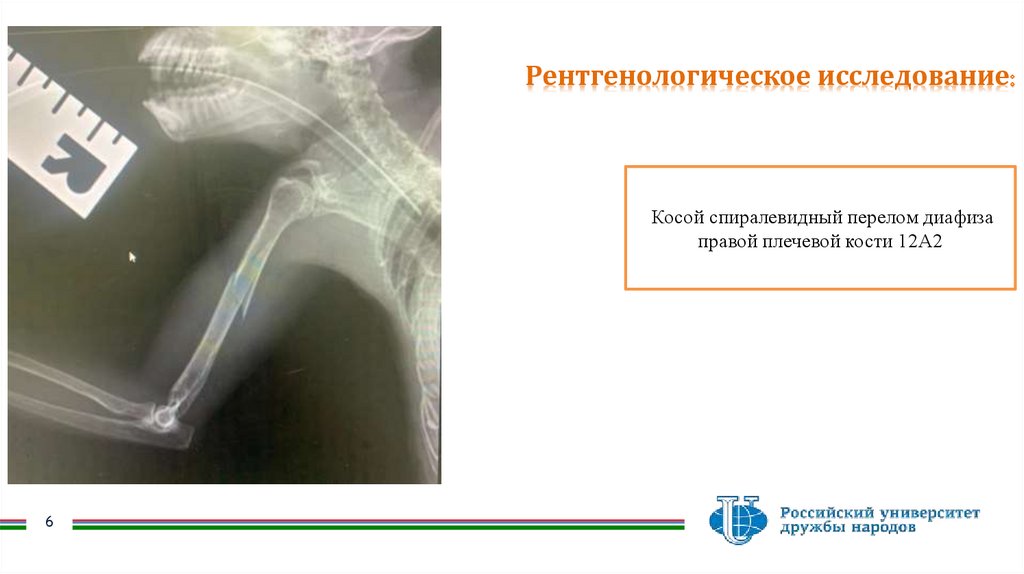 Рентгенологическое исследование: