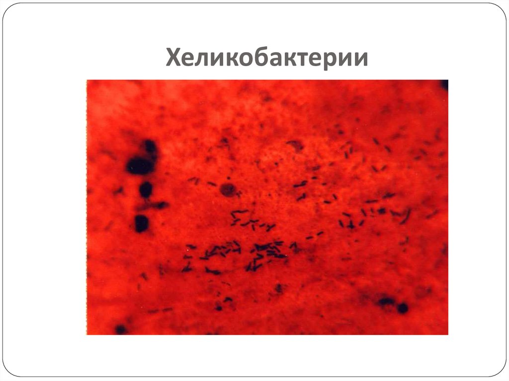 Хеликобактериозы. Лабораторная диагностика - презентация онлайн