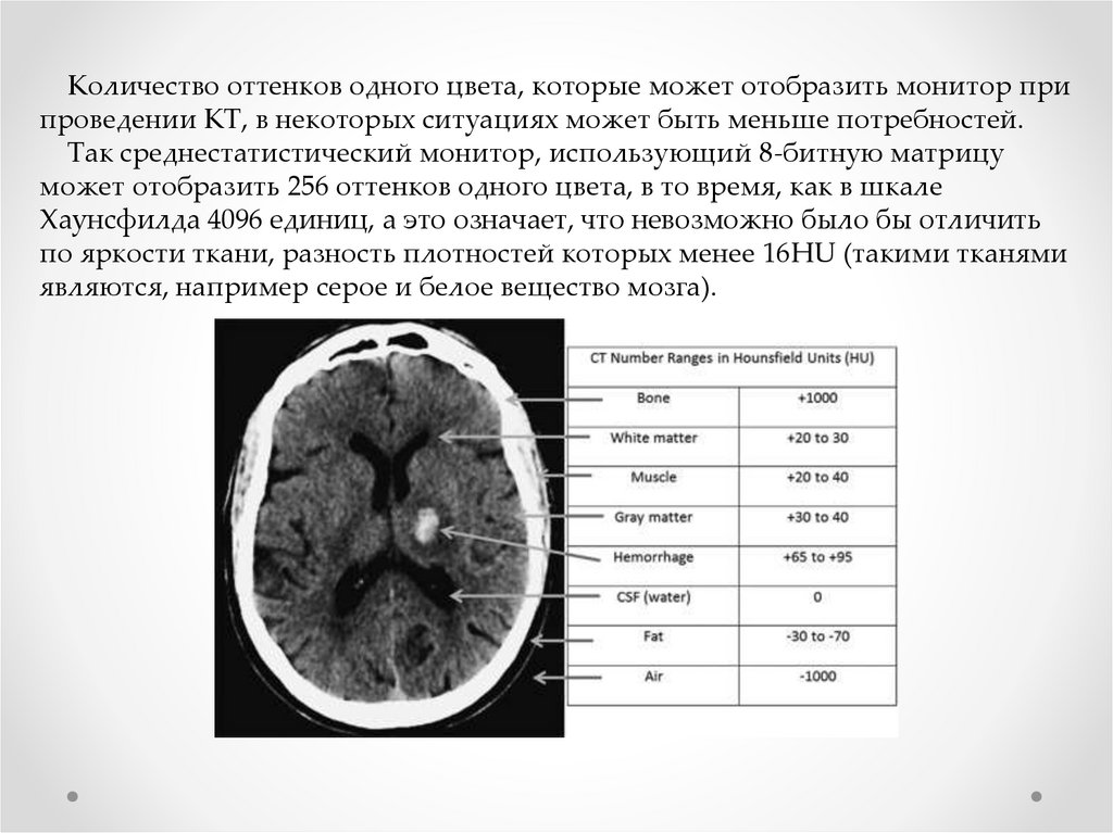 Шкала хаунсфилда презентация