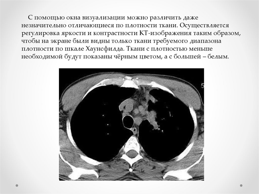 Шкала хаунсфилда презентация