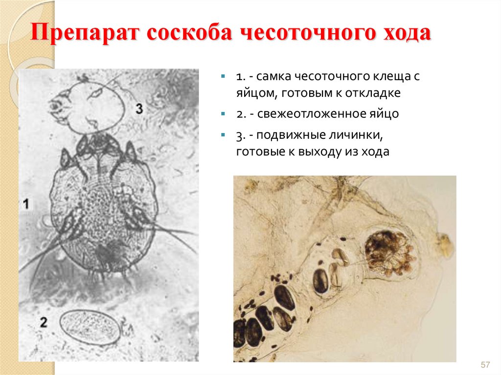 Средство от чесоточного клеща