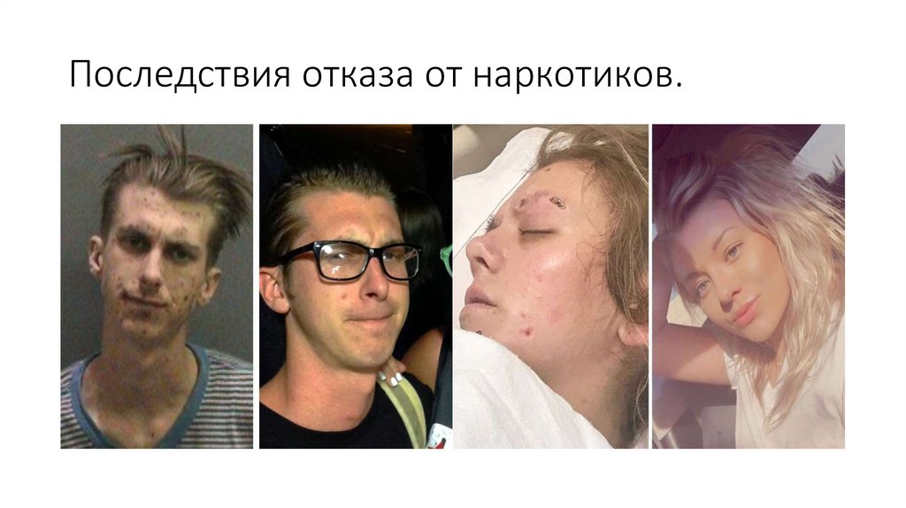 Последствия отказа от наркотиков.