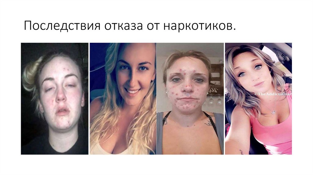 Последствия отказа от наркотиков.