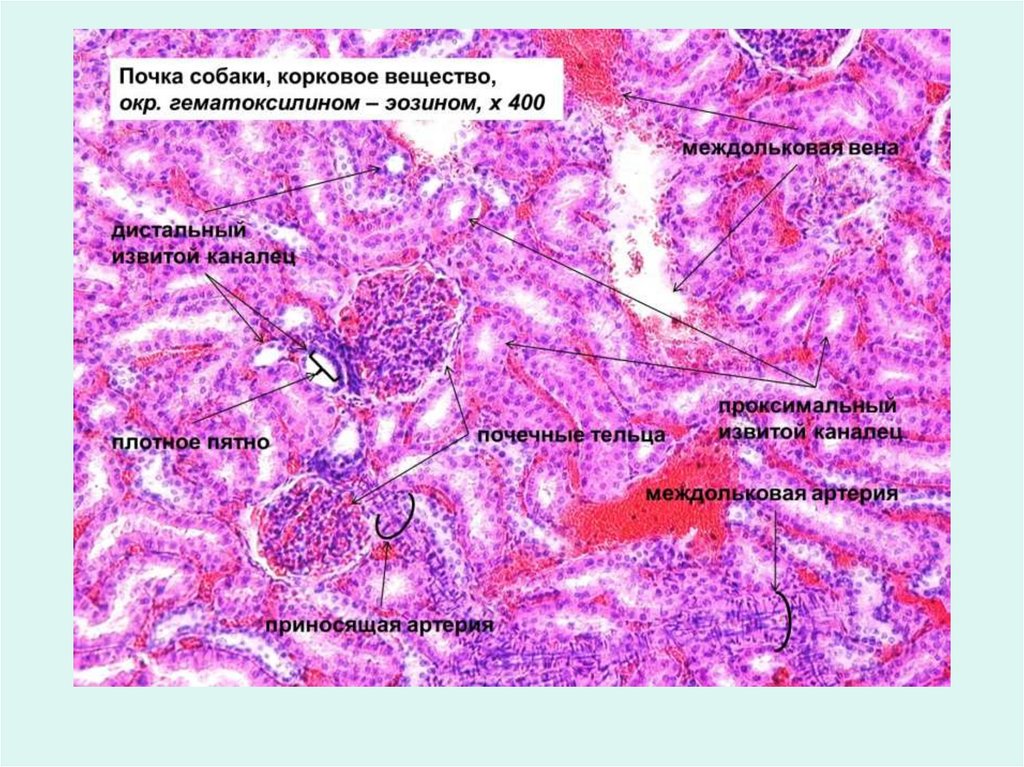 Почка гистология рисунок