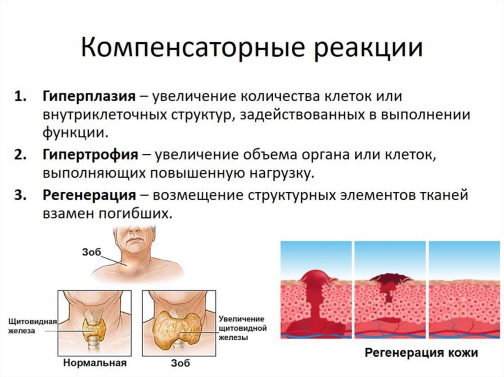 Определите вид компенсаторно приспособительных реакций подпишите картинки