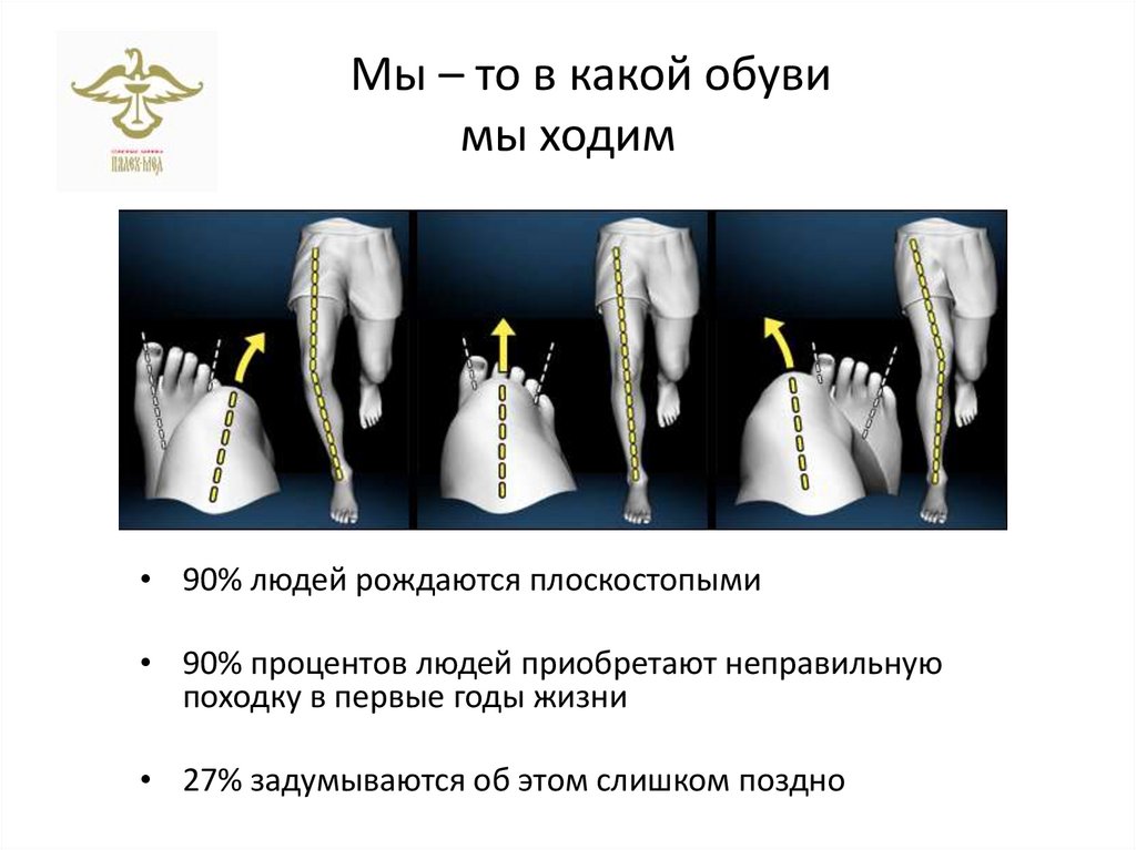 Мы – то в какой обуви мы ходим