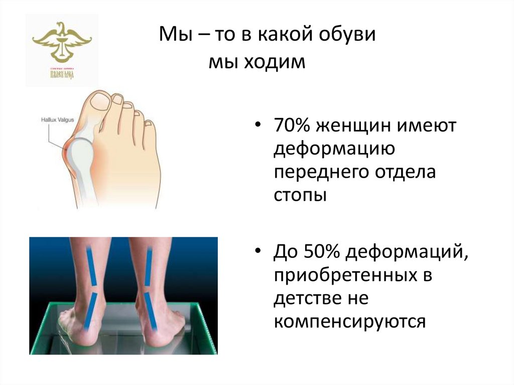 Мы – то в какой обуви мы ходим