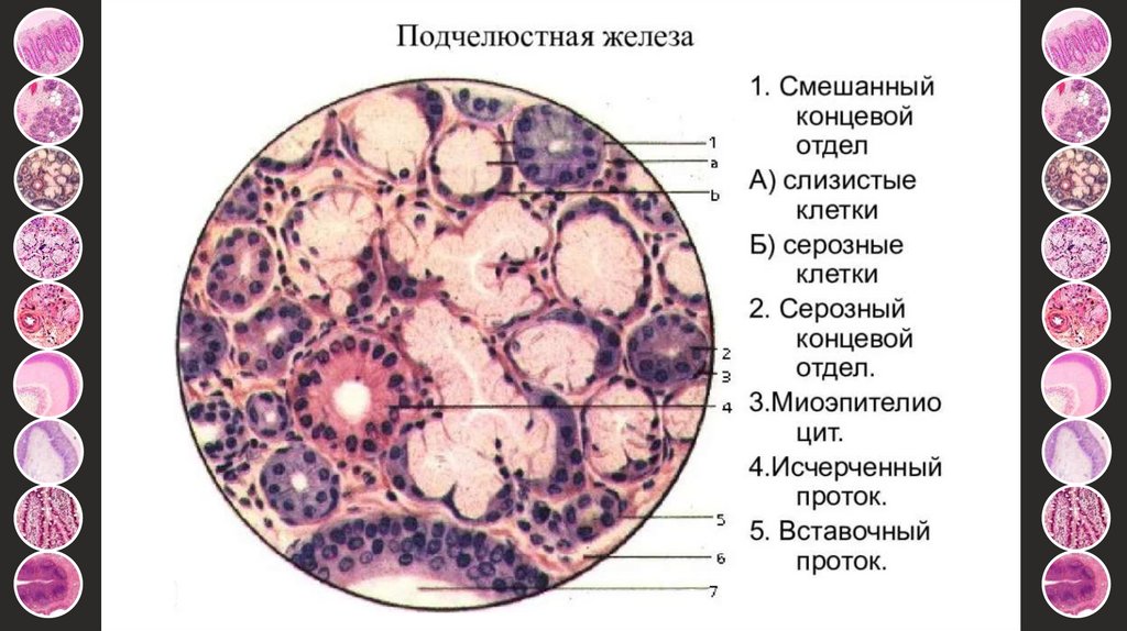 Отдел конечный. Клетки слюнной железы гистология. Смешанный концевой отдел подчелюстной железы. Слизистые концевые отделы слюнных желез препарат. Подчелюстная железа гистология.