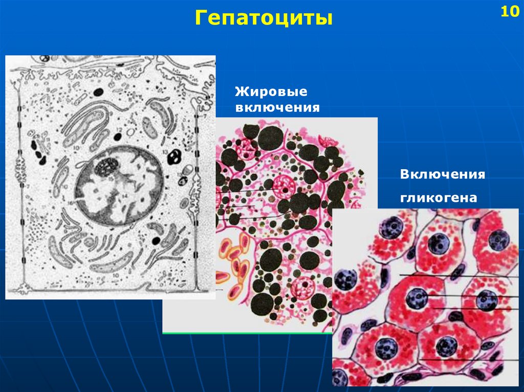 Процесс сопровождающийся накоплением в цитоплазме гепатоцитов. Жировые включения в гепатоцитах гистология. Жировые включения в гепатоцитах печени. Гепатоциты печени гистология. Строение гепатоцита.