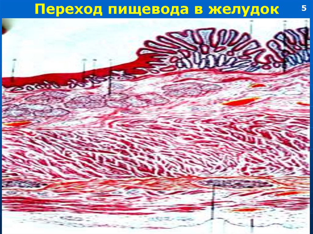 Железы пищевода. Место перехода пищевода в желудок это. Переход из пищевода в желудок гистология. Переход пищевода в желудок рисунок. Переход пищевода в желудок препарат.