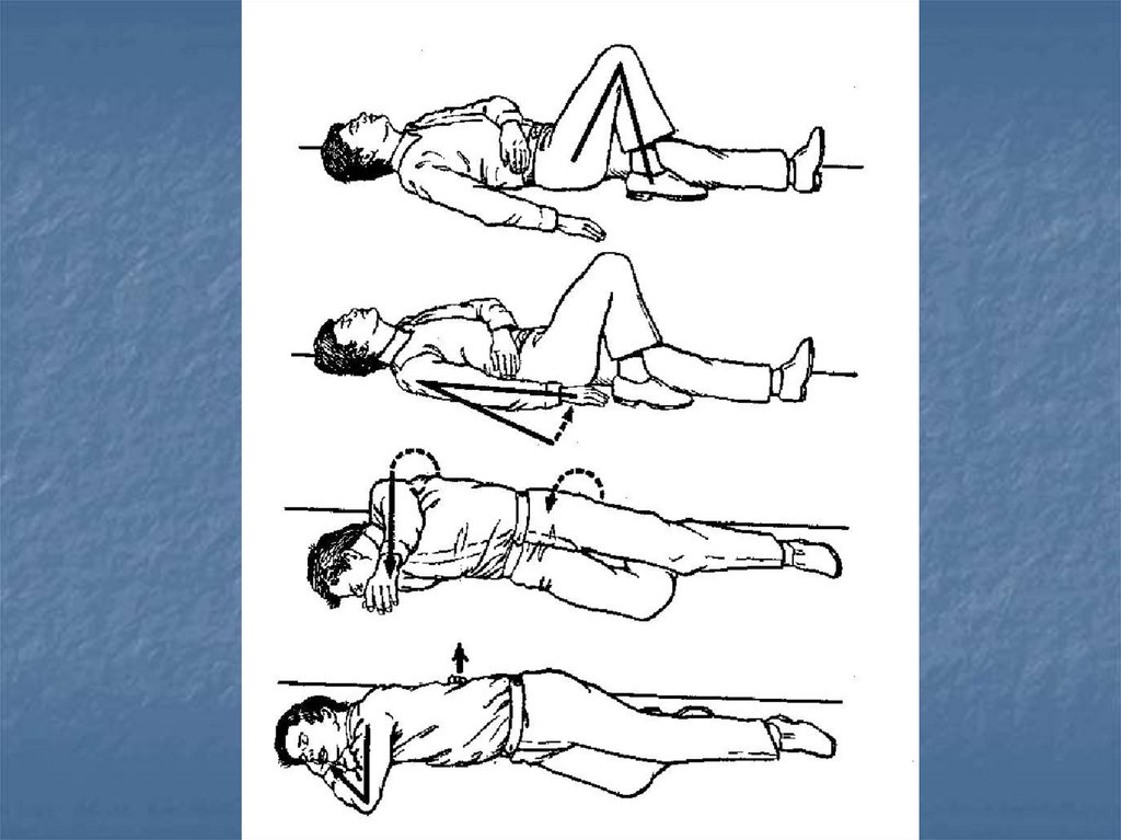 Позиция больного при проведении реанимационных мероприятий. СЛР схема. Реанимационные мероприятия картинки.