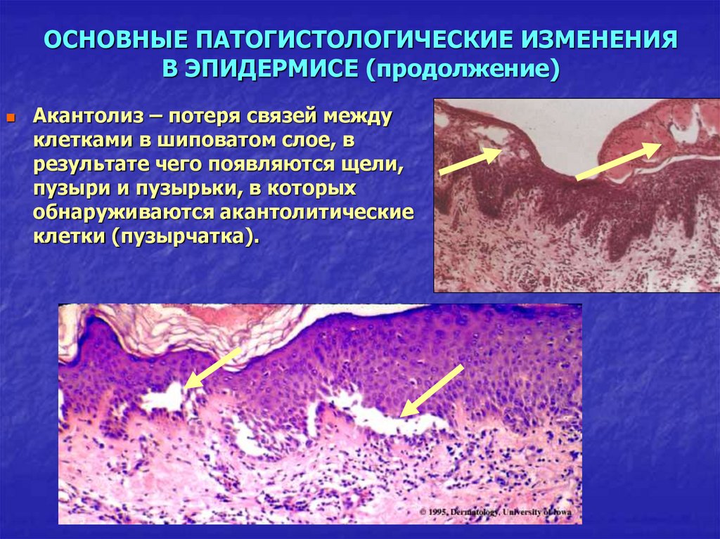 Первичные и вторичные элементы сыпи презентация