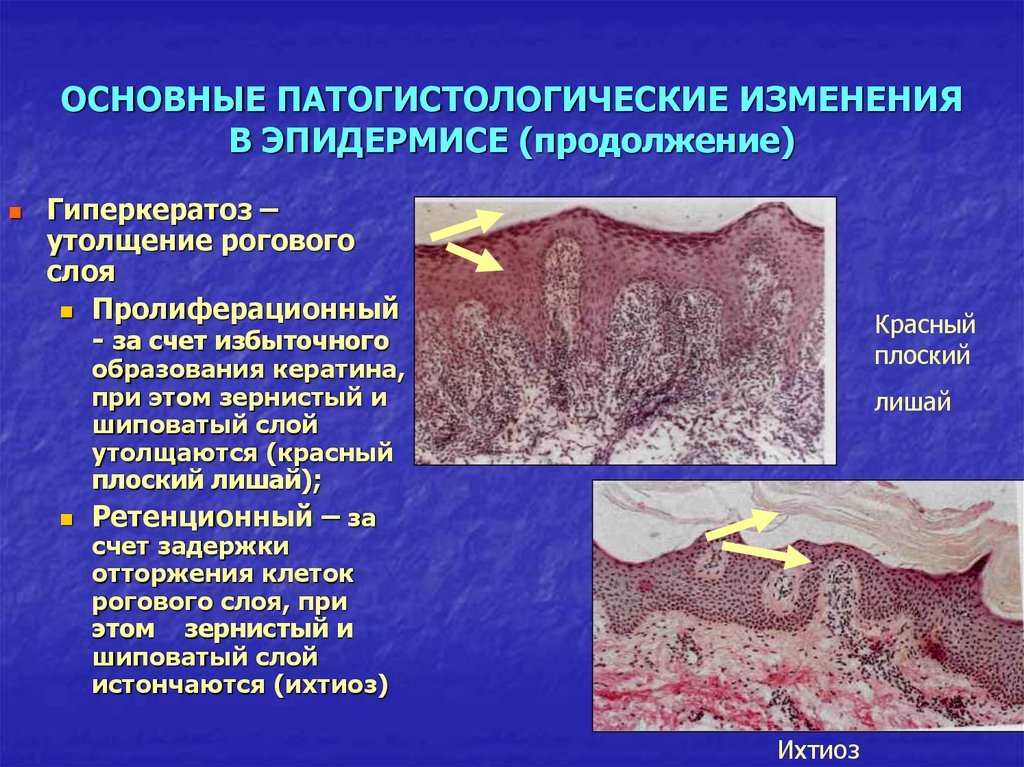 Первичные и вторичные элементы сыпи презентация