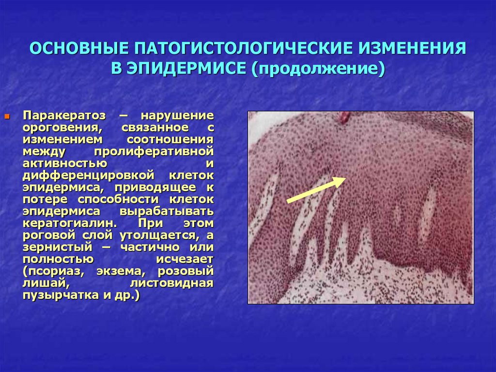 Первичные и вторичные элементы сыпи презентация