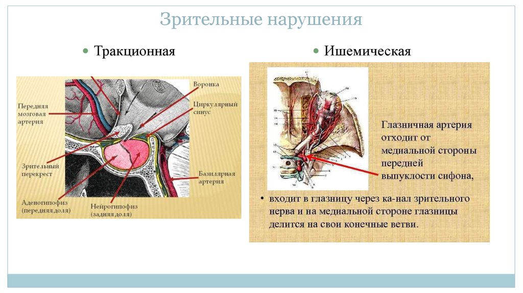 Пустое турецкое седло - презентация онлайн