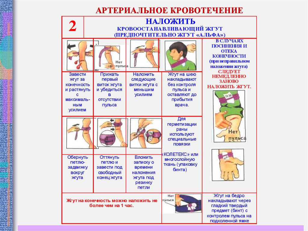 Артериальное кровотечение первая помощь. Первая помощь при артериальном кровотечении алгоритм. Оказание первой помощи в случае артериального кровотечения. Действия при артериальном кровотечении. Алгоритм действий при артериальном кровотечении.