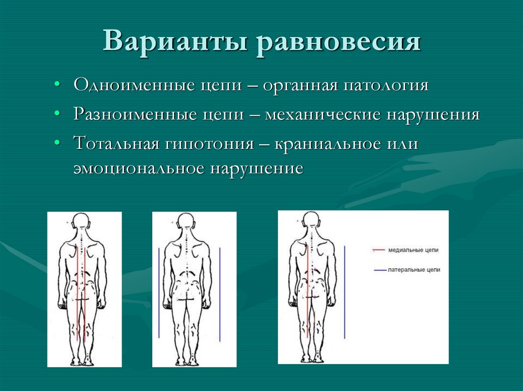 Глубинная вентральная цепь. Вентральное положение. Глубинное нарушение