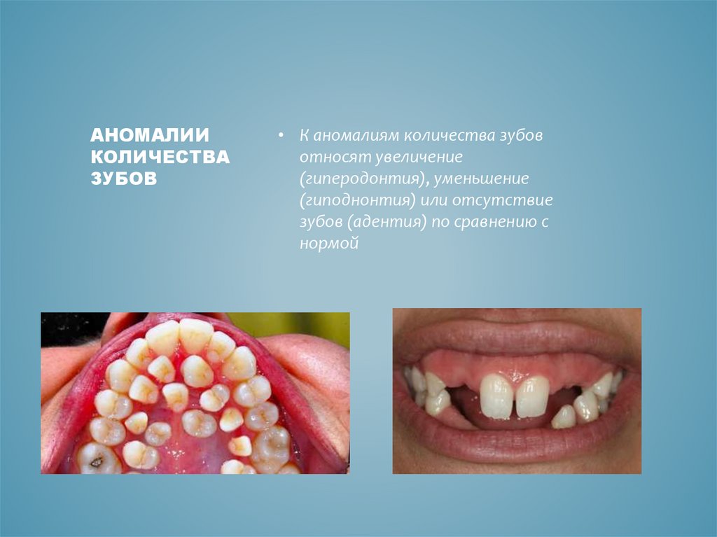 Ogse странная аномалия