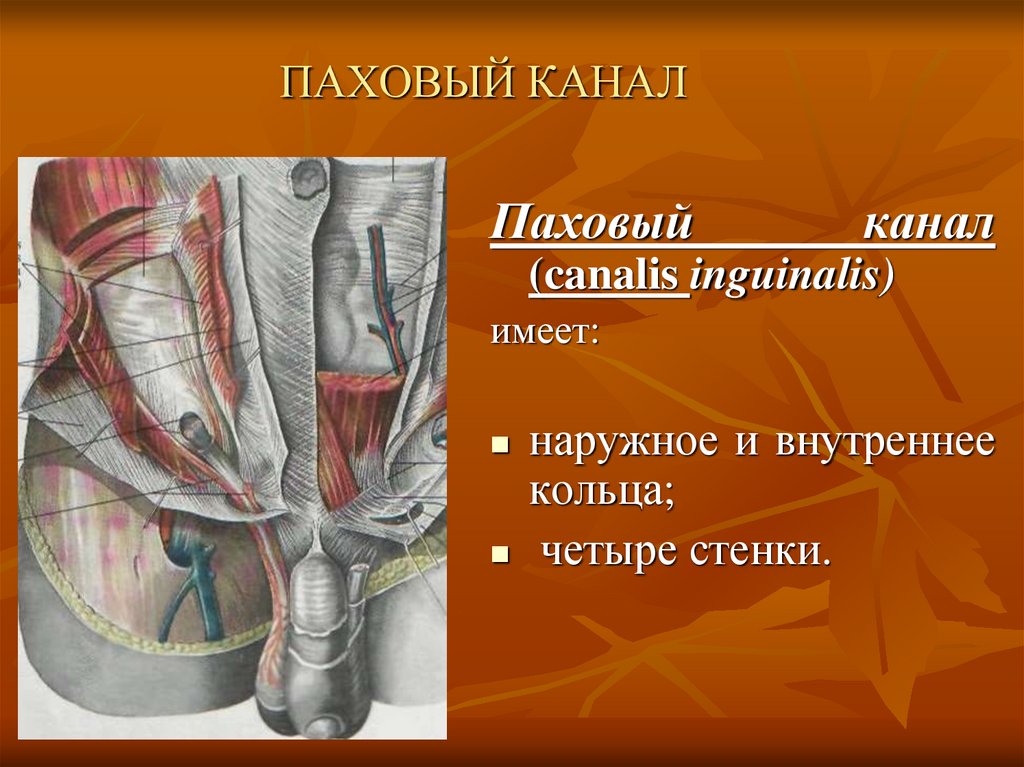 Болит паховая область у мужчин. Внутреннее паховое кольцо анатомия. Паховый канал, Canalis inguinalis:. Верхняя стенка пахового канала. Поверхностное кольцо пахового канала.