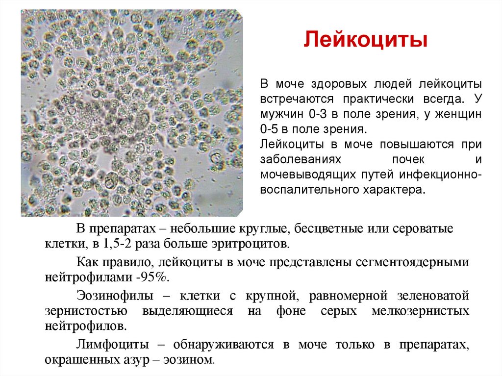 Лейкоциты в моче 50 у мужчины. Микроскопическое исследование мочевого осадка лейкоциты 0-2-2. Лейкоциты в моче микроскопия. Моча лейкоциты (микроскопия) 2/ПВУ. Лейкоциты 2-3-4 в моче.