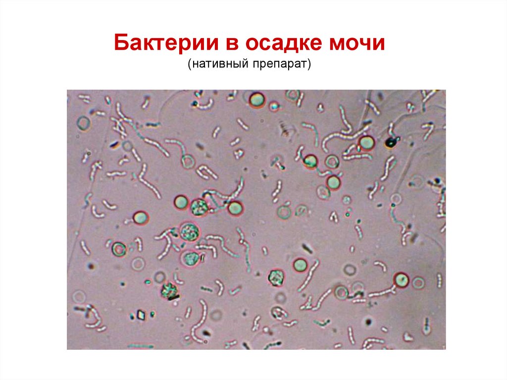 Что означает большое количество бактерий в моче. Бактерии в моче микроскопия осадка. Бактерии в моче при микроскопии. Бактерии в осадке мочи. Бактерии в моче под микроскопом.