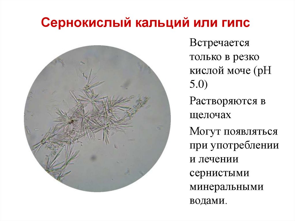 Фосфаты в какой моче. Кристаллы сернокислого кальция в моче. Сернокислая известь в осадке мочи. Кислый мочекислый аммоний в микроскопии мочи. Сернокислый кальций в моче микроскопия.