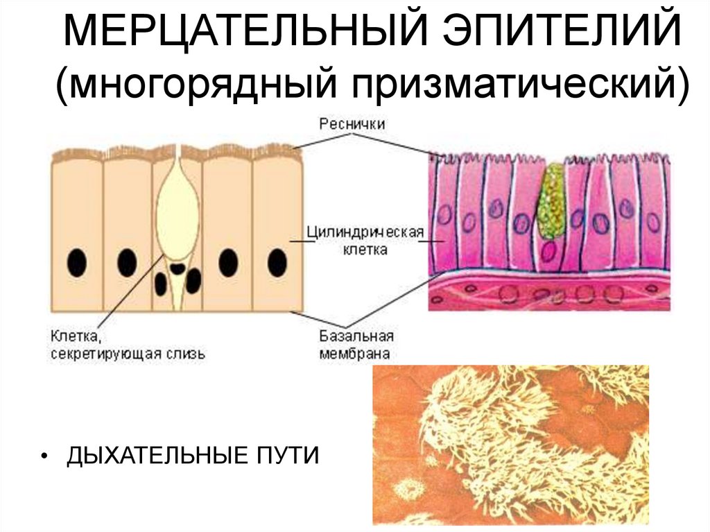 Клетки многорядного эпителия