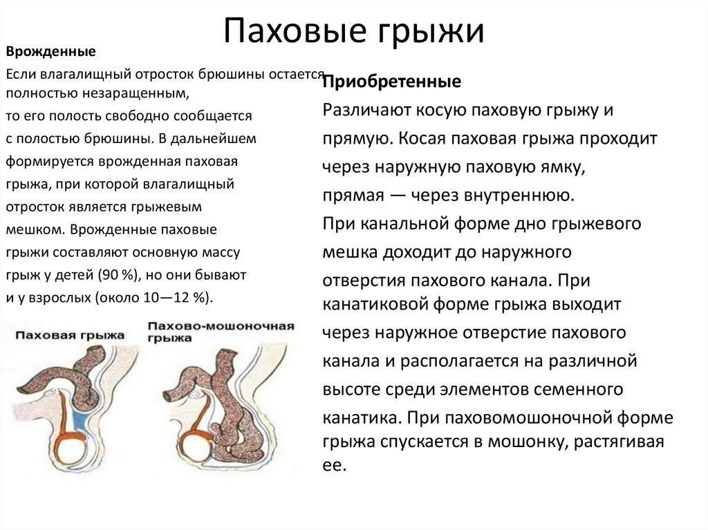 Внутренние органы могут составлять часть стенки грыжевого мешка при следующих грыжах тест