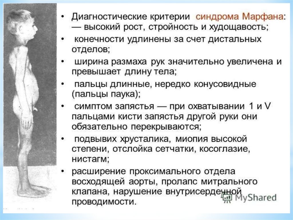 Методы исследования костно мышечной системы презентация