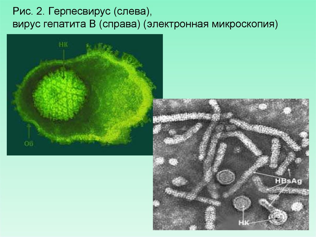 Рис. 2. Герпесвирус (слева), вирус гепатита В (справа) (электронная микроскопия)