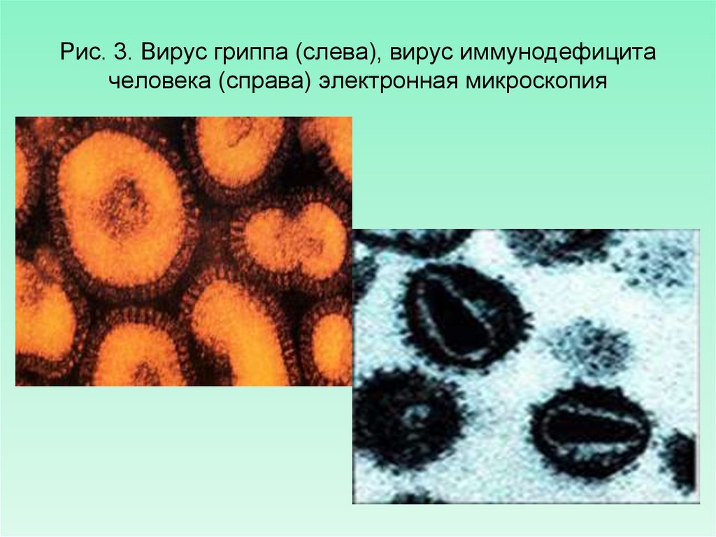 Рис. 3. Вирус гриппа (слева), вирус иммунодефицита человека (справа) электронная микроскопия