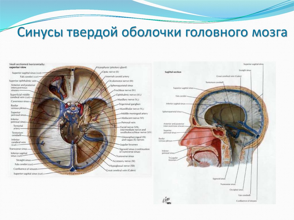 Синусы фото. Синусы твёрдой мозговой оболочки анатомия. Синусы твердой мозговой оболочки латынь. Поперечный синус твердой мозговой оболочки. Синусы твердой мозговой оболочки схема.