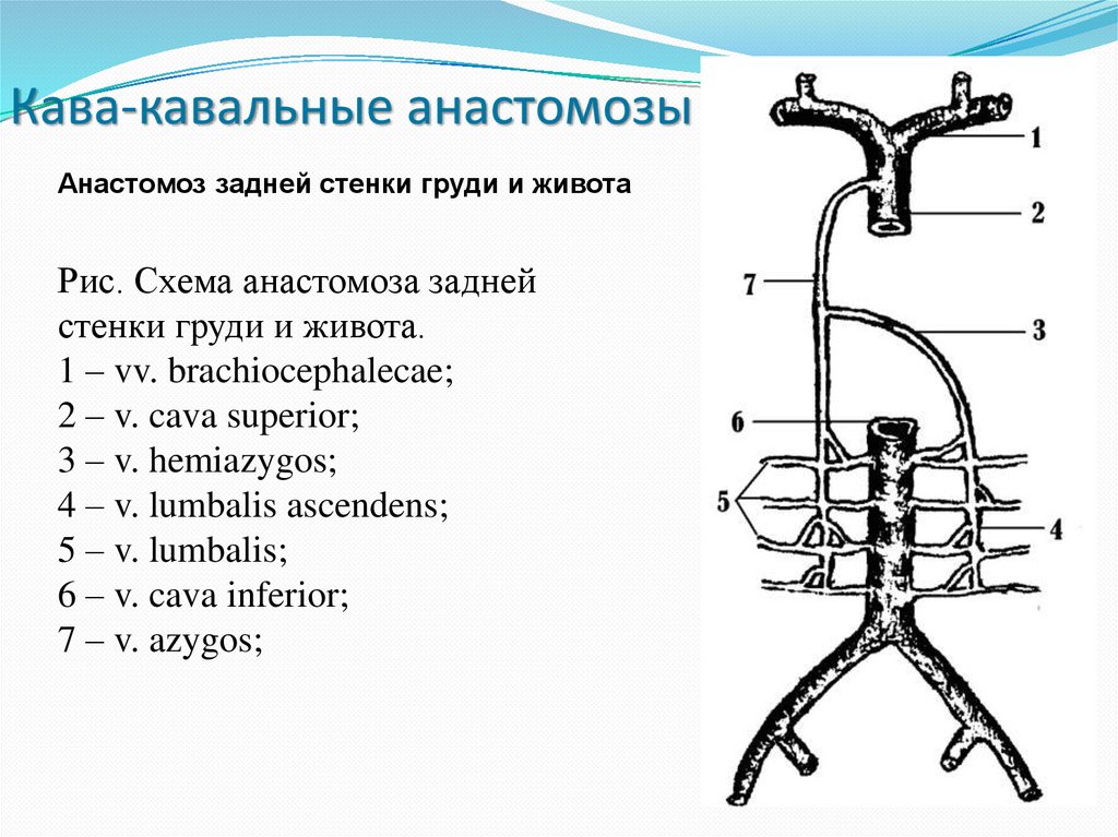 Порто кава кавальный. Портокавальные анастомозы таблица. Кава кавальные и портокавальные анастомозы таблица. Кавакавальные анастомозы анатомия. Схема кава кавальных анастомозов.