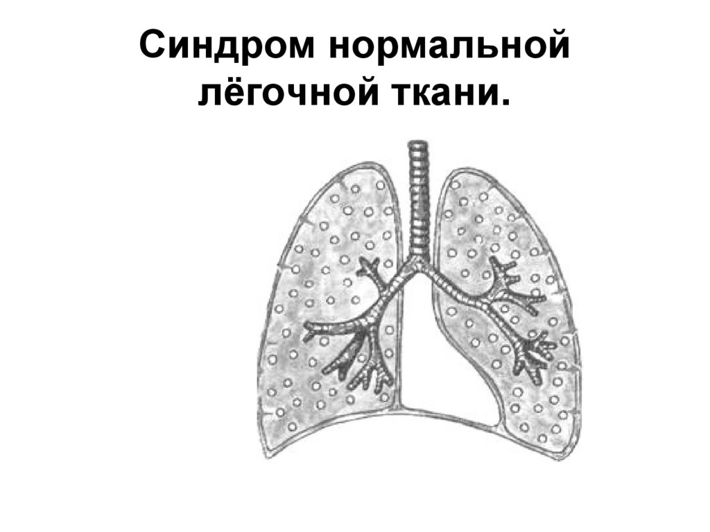 Легочная ткань. Нормальная легочная ткань. Легочная тень. Из чего состоит легочная ткань.