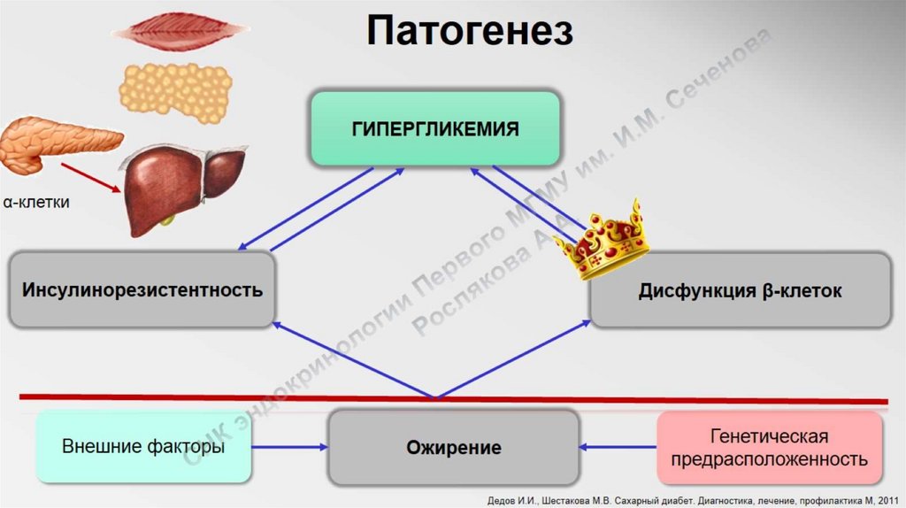 Диабет 2 типа презентация