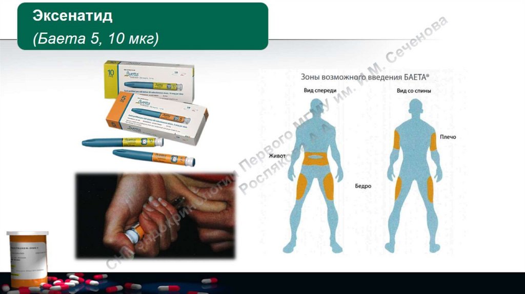 Возможное введение. Эксенатид. Баета 5 мкг. Эксенатид аналоги. Баета 10 мкг.