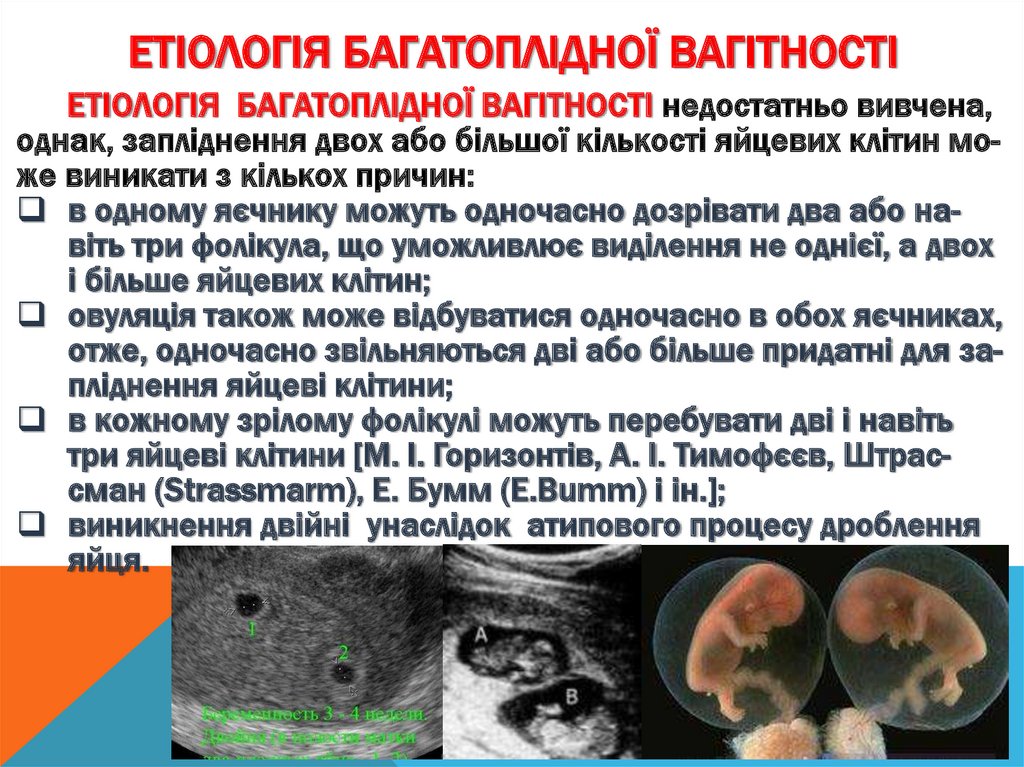 Етіологія Багатоплідної вагітності