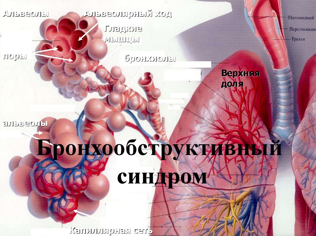 Бронхообструктивный синдром презентации