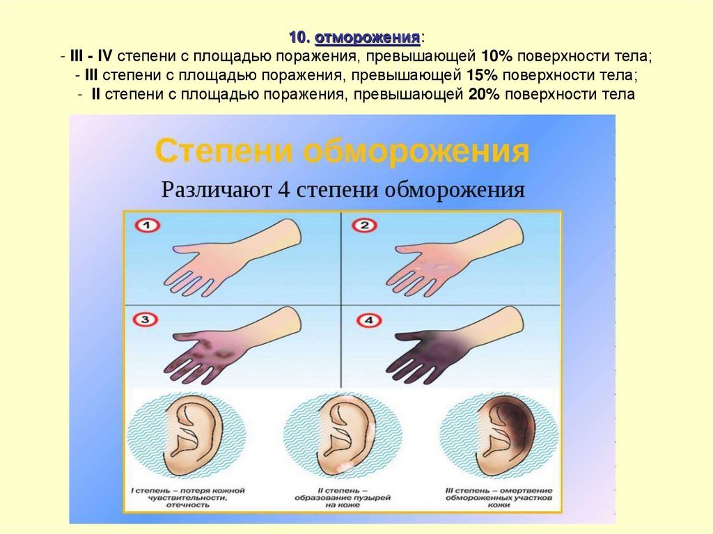 15 поражения. Отморожение по площади поражения.