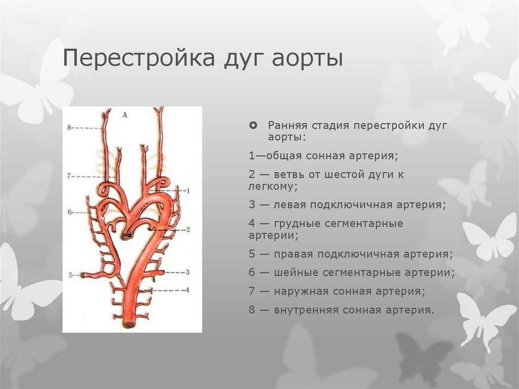 Ствол дуги аорты