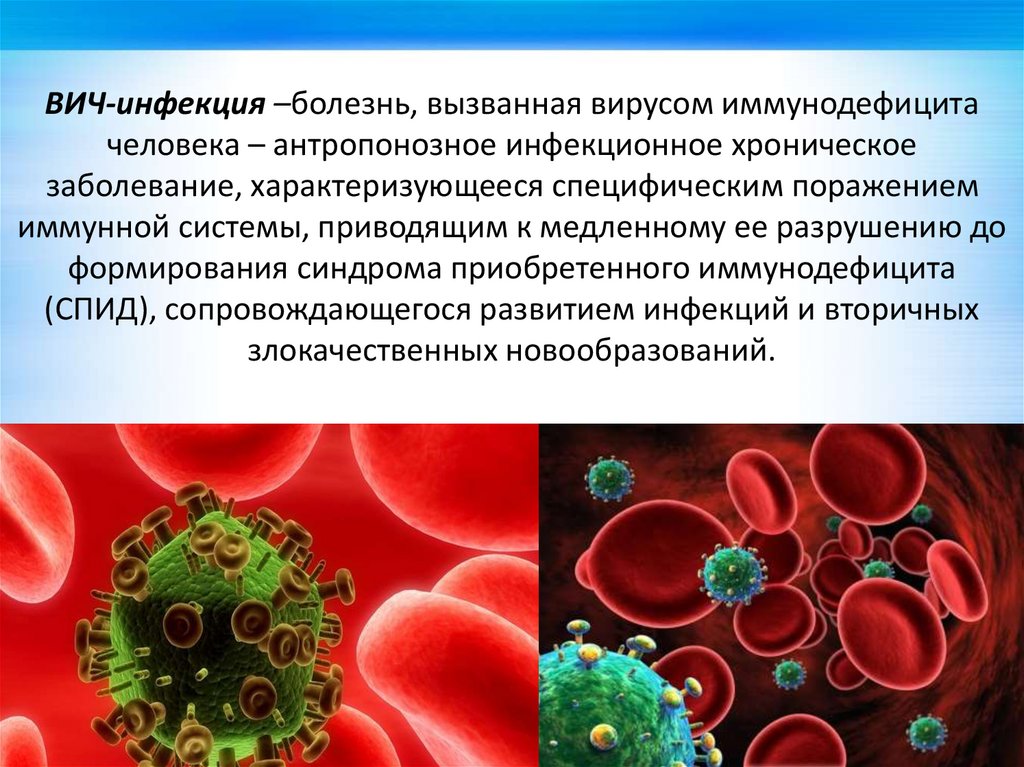 Вызываемого вирусом иммунодефицита человека