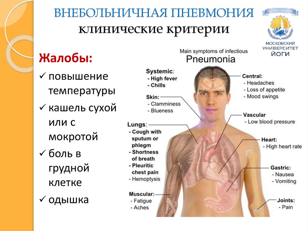 Презентации внебольничная пневмония