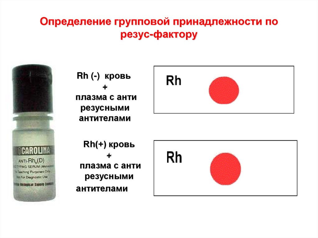 Резус фактор определяют тест. Цоликлон группа крови резус. Цоликлоны для определения резус фактора крови. Определить резус-фактор крови цоликлонами анти д. Цоликлоны анти резус.