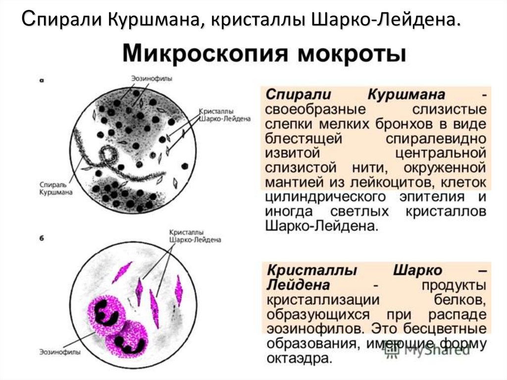 Слизи характеристика. Микроскопия мокроты спирали Куршмана. Спирали Куршмана, Кристаллы Шарко-Лейдена, эозинофилы. Клетки при микроскопии мокроты. Спирали Куршмана в мокроте.
